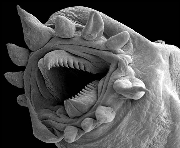 Tardigrades