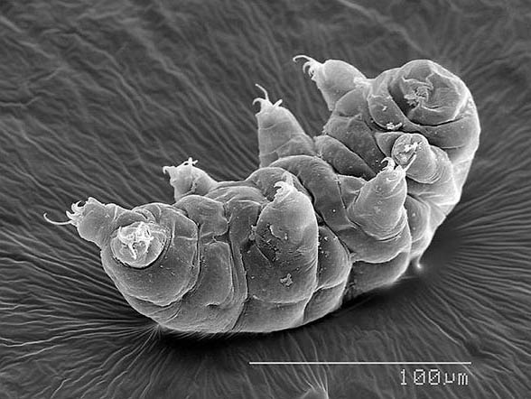 Tardigrades